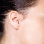 Dove fare otoplastica Milano