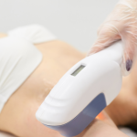 Centro per epilazione laser a Milano